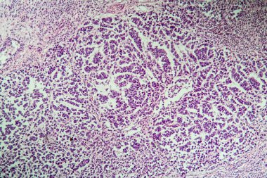 Mikroskop altında omurilik dokusu bölümü 100x