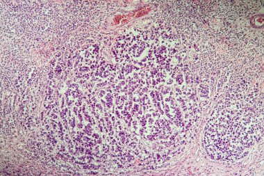 Mikroskop altında omurilik dokusu bölümü 100x