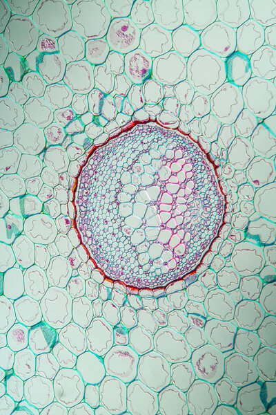 Fern stems in cross section 100x