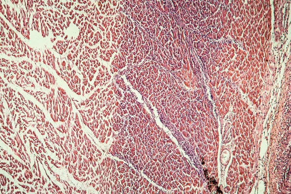 Cardiac muscle after infarction, tissue section 100x