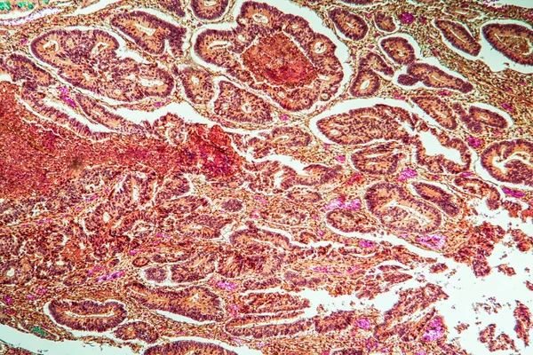 绒毛和杯状细胞癌肠系膜组织第100X节 — 图库照片