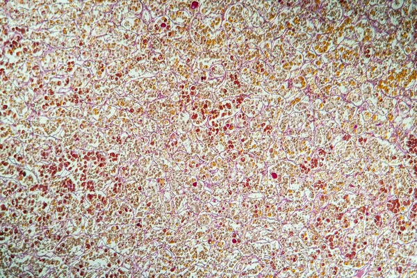 Hypofysen Vävnadsdelen Mikroskopet 100X — Stockfoto