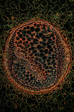 Bracken 100x kesitinde saplanır