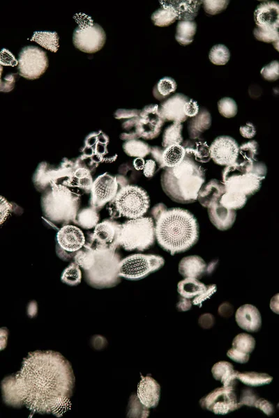Радиолярия Морских Животных Микроскопом 100X — стоковое фото