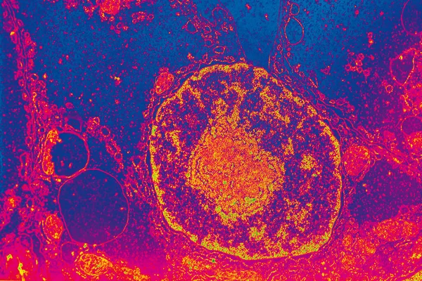 Cell nucleus with organelles in the electron microscope 50,000x