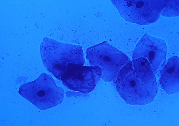Cellules Épithéliales Muqueuse Buccale Avec Noyaux Cellulaires — Photo