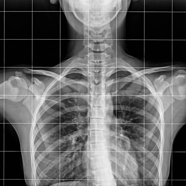 X-ray of the Spinal Column. — Stock Photo, Image