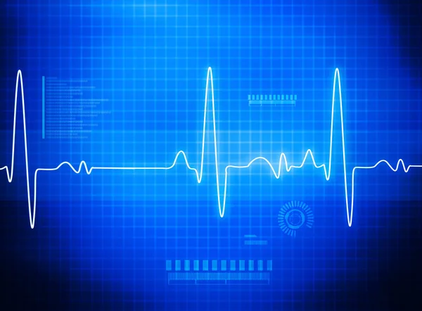 Ecg Antecedentes Eletrocardiográficos Médicos Assistenciais — Fotografia de Stock