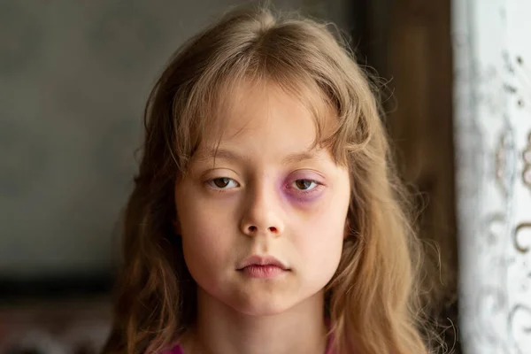 Portré Egy Szomorú Ijedt Kislányról Veréssel Gyermekbántalmazás Erőszak — Stock Fotó