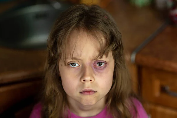 Portrait Sad Scared Little Girl Beating Child Domestic Abuse Violence — Stock Photo, Image