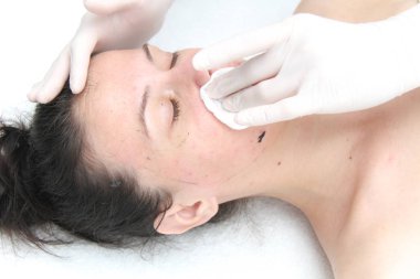 Kozmetik prosedürler, seçici odaklanma