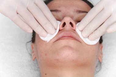 Kozmetik prosedürler, seçici odaklanma