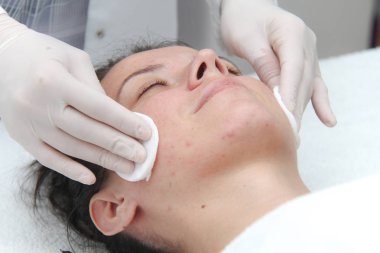 Kozmetik prosedürler, seçici odaklanma