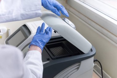 Coronavirus tarafından Covid-19 etiketli biyolojik bir tüp ile kirletilmiş biyolojik bir tüp ve Covid-19 enfeksiyonlu diyabet analizi için laboratuvarda doktor.