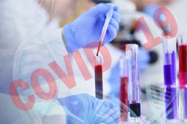 Coronavirus 'u kabul et. Corona virüsü tedavisi için bilim adamı ya da doktor araştırması ilaç ve laboratuvarda ya da hastanede araştırma.