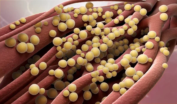 Staphylococcus aureus Bakterien — Stockfoto