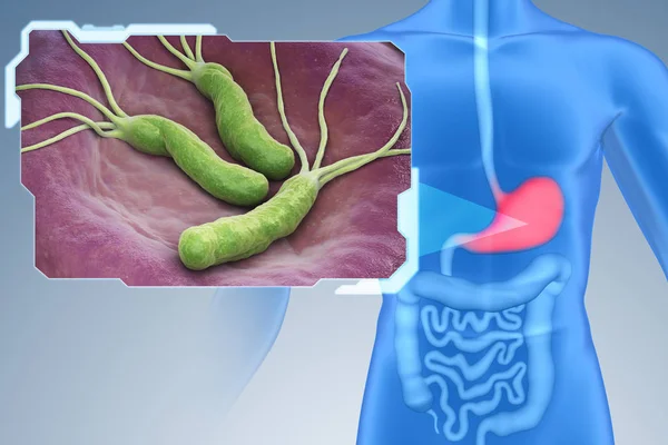 Helicobacter pylori βακτήρια — Φωτογραφία Αρχείου