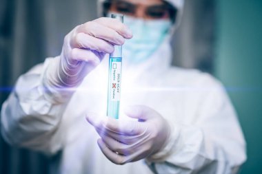 Tıbbi laboratuvar teknisyenleri test tüplerini COVID-19 salgını, Salgın Virüs Solunum Sendromu 'nda 2019-nCoV ya da Coronavirus laboratuvar testleriyle kirlettiler.