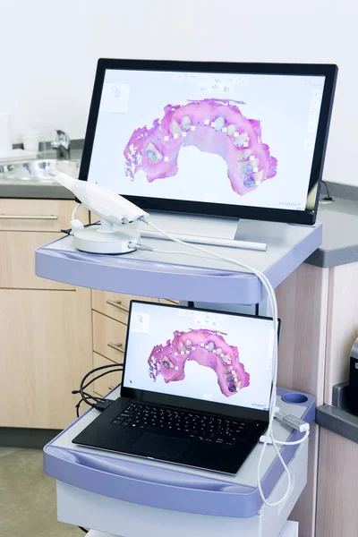 Moderno Monitor Laptop Con Scansioni Dei Denti Posizionati Sugli Scaffali — Foto Stock