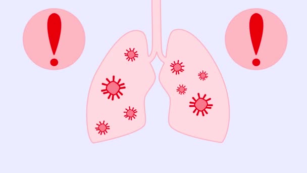 Κινούμενα σχέδια του Covid-19 ή του ιού της κόμης στους πνεύμονες και στο αναπνευστικό σύστημα ενός ατόμου. Η εξάπλωση του ιού στους ανθρώπινους πνεύμονες. Συναγερμός — Αρχείο Βίντεο