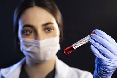 Cerrahi maskeli, mavi renkli muayene eldivenli, beyaz kadın doktor elinde siyah bir arka plan üzerinde 