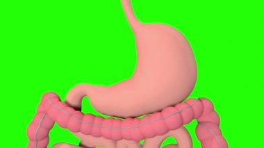 Bu video gastrik balonun kilo kaybı için endoskopik eklenişini gösterir