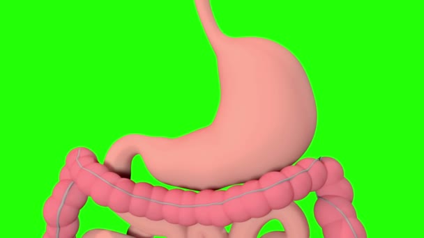 Ten Film Pokazuje Endoskopowe Wkładanie Balonu Żołądkowego Odchudzania — Wideo stockowe