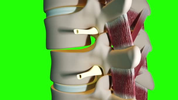 这段医疗录像显示椎间盘置换术 — 图库视频影像