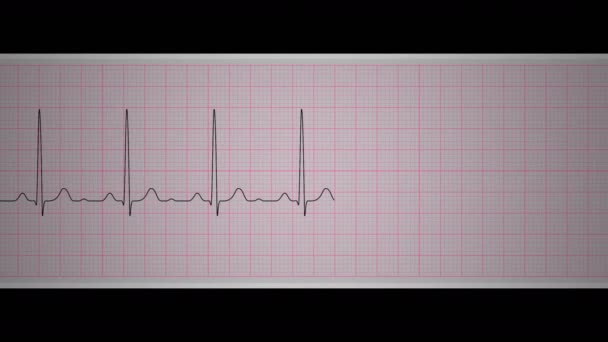 Loop Video Shows Normal Sinus Tracked Medical Paper Streep — Stockvideo