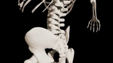 This video shows the coccydynia condition