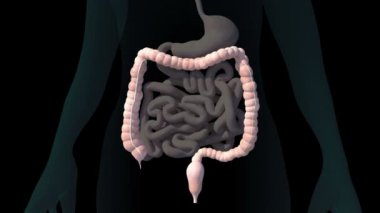 This video shows a 3d animation of an irritable bowel
