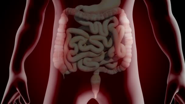 Este Vídeo Mostra Procedimento Polipectomia Cólon — Vídeo de Stock