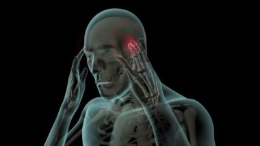 Bu 3D video tapınaklardaki baş ağrısını gösteriyor.