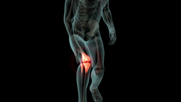 这段录像显示一个人膝部疼痛 — 图库视频影像