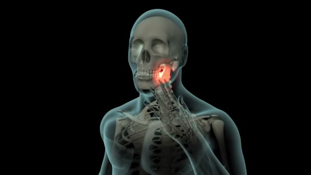 Dieses Video Zeigt Den Zustand Der Zahnschmerzen — Stockvideo