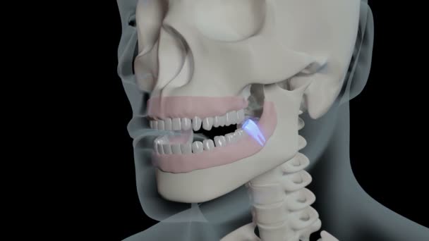 这个视频展示了智慧牙齿的炎症 — 图库视频影像