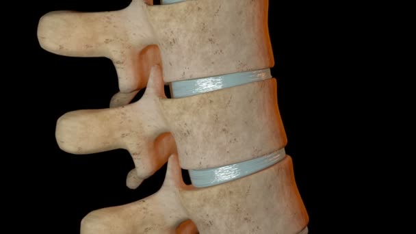 Cette Vidéo Montre Fracture Flexion Vertèbre — Video