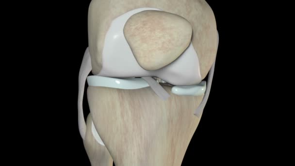 Video Shows Anterior Cruciate Ligament Rupture — Stock Video