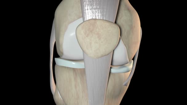 Dieses Video Zeigt Den Osteochondralen Patellasehnenbruch — Stockvideo