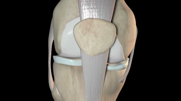 这段录像显示的是横移移位的膝盖骨骨折 — 图库视频影像