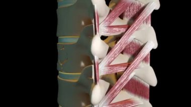 Bu video vertebroplasti prosedürünü gösterir