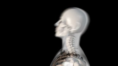 Bu video omurilik zedelenmesini gösteriyor.