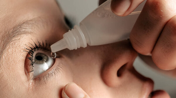 Attractive girl dripping right eye drops, introduces them under eyelid into conjunctival sac, looks up with her head thrown back. Glaucoma, cataracts, eye diseases, allergy, conjunctivitis concepts