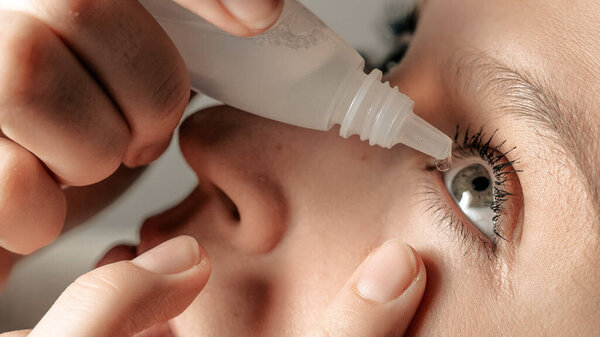 Attractive girl dripping left eye drops, introduces them under eyelid into conjunctival sac, looks up with her head thrown back. Glaucoma, cataracts, eye diseases, allergy, conjunctivitis concepts
