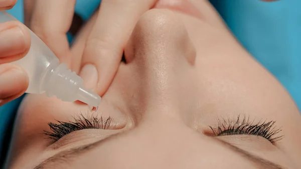 Beauty girl dripping eye drops, introduces them under eyelid into right eye of conjunctival sac, looks up her head thrown back. Glaucoma, cataracts, eye diseases, allergy, conjunctivitis concepts