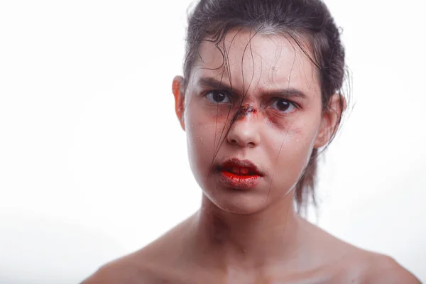 Fiatal Zúzódásokkal Arcán Családon Belüli Erőszak Áldozata Női Harcos Véres — Stock Fotó