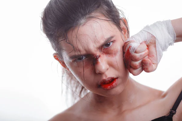 Jonge Vrouw Met Blauwe Plekken Het Gezicht Slachtoffer Van Huiselijk — Stockfoto