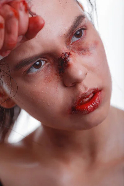 Jonge Vrouw Met Blauwe Plekken Het Gezicht Slachtoffer Van Huiselijk — Stockfoto