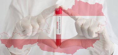 Coronavirus kavramsal fotoğrafı, tıbbi eldiven takmış doktorların elinde COVID-19 salgını ve Avusturya ulusal bayrağı için kan testi sonuçları var.