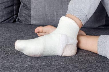 Bir bacak yakın genç kız fiberglas. Bacağında alçı bandaj olan çocuk ve ayak parmaklarında kırık, çıkık, burkulma. İnsan sağlığı ve tıp konsepti 